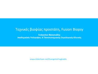 Tεχνικές βιοψίας προστάτη, Fusion Biopsy
Ευάγγελος Φραγκιάδης
Ακαδημαϊκός Υπότροφος: Α΄Πανεπιστημιακής Ουρολογικής Κλινικής
www.slideshare.net/EvangelosFragkiadis
 