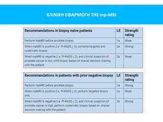 ΚΛΙΝΙΚΗ ΕΦΑΡΜΟΓΗ ΤΗΣ mp-MRI
 