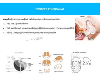 ΠΡΟΣΠΕΛΑΣΗ ΒΙΟΨΙΑΣ
Διορθική υπερηχογραφικά καθοδηγούμενη βιοψία προστάτη
 Υπό τοπική αναισθησία
 Υπό αντιβιοτική χημειοπροφύλαξη (φθοριοκινολόνη +/-αμινογλυκοσίδη)
 Λήψη 12 τεμαχιδίων κάνοντας σάρωση του προστάτη
 