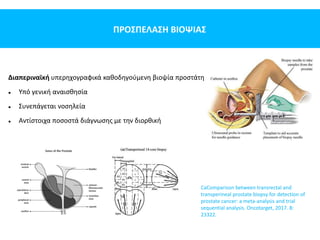ΠΡΟΣΠΕΛΑΣΗ ΒΙΟΨΙΑΣ
CaComparison between transrectal and
transperineal prostate biopsy for detection of
prostate cancer: a meta-analysis and trial
sequential analysis. Oncotarget, 2017. 8:
23322.
Διαπεριναϊκή υπερηχογραφικά καθοδηγούμενη βιοψία προστάτη
 Υπό γενική αναισθησία
 Συνεπάγεται νοσηλεία
 Αντίστοιχα ποσοστά διάγνωσης με την διορθική
 