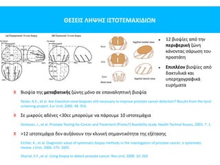 ΘΕΣΕΙΣ ΛΗΨΗΣ ΙΣΤΟΤΕΜΑΧΙΔΙΩΝ
 12 βιοψίες από την
περιφερική ζώνη
κάνοντας σάρωση του
προστάτη
 Επιπλέον βιοψίες από
δακτυλικά και
υπερηχογραφικά
ευρήματα
X Βιοψία της μεταβατικής ζώνης μόνο σε επαναληπτική βιοψία
Pelzer, A.E., et al. Are transition zone biopsies still necessary to improve prostate cancer detection? Results from the tyrol
screening project. Eur Urol, 2005. 48: 916.
X Σε μικρούς αδένες <30cc μπορούμε να πάρουμε 10 ιστοτεμάχια
Donovan, J., et al. Prostate Testing for Cancer and Treatment (ProtecT) feasibility study. Health Technol Assess, 2003. 7: 1.
X >12 ιστοτεμάχια δεν αυξάνουν την κλινική σημαντικότητα της εξέτασης
Eichler, K., et al. Diagnostic value of systematic biopsy methods in the investigation of prostate cancer: a systematic
review. J Urol, 2006. 175: 1605.
Shariat, S.F., et al. Using biopsy to detect prostate cancer. Rev Urol, 2008. 10: 262.
 