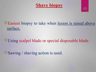 Shave biopsy
Easiest biopsy to take when lesion is raised above
surface.
Using scalpel blade or special disposable blade.
...