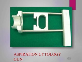 ASPIRATION CYTOLOGY
GUN 60
 