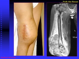 Freih Abu Hassan 
Jordan University  