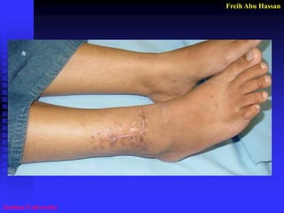 Freih Abu Hassan 
Jordan University  