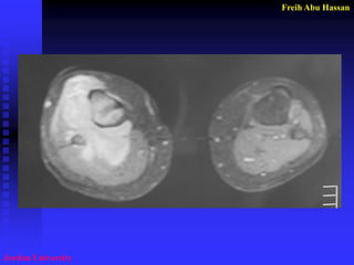 Freih Abu Hassan 
Jordan University  