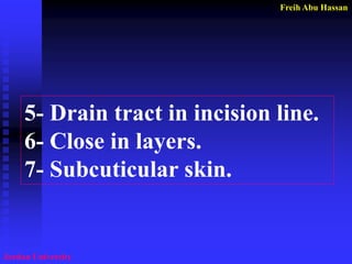 Freih Abu Hassan 
Jordan University 
5- Drain tract in incision line. 
6- Close in layers. 
7- Subcuticular skin.  