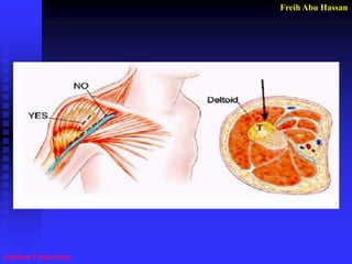 Freih Abu Hassan 
Jordan University  