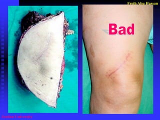 Freih Abu Hassan 
Jordan University  