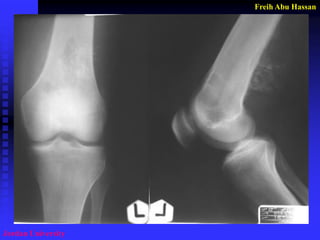 Freih Abu Hassan 
Jordan University  