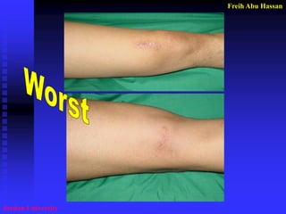 Freih Abu Hassan 
Jordan University  