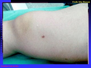 Freih Abu Hassan 
Jordan University  