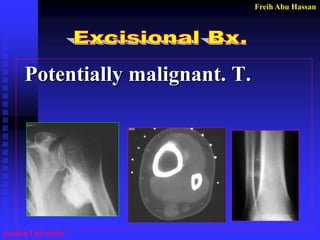 Freih Abu Hassan 
Jordan University 
Potentially malignant. T.  