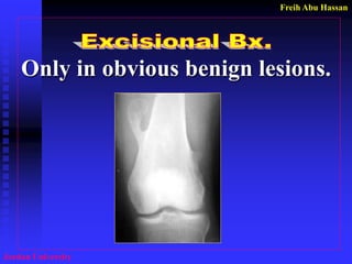 Freih Abu Hassan 
Jordan University 
Only in obvious benign lesions. 
 