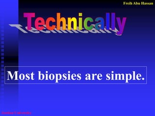 Freih Abu Hassan 
Jordan University 
Most biopsies are simple.  