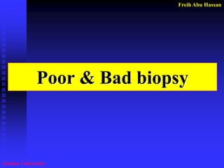 Freih Abu Hassan 
Jordan University 
Poor & Bad biopsy  