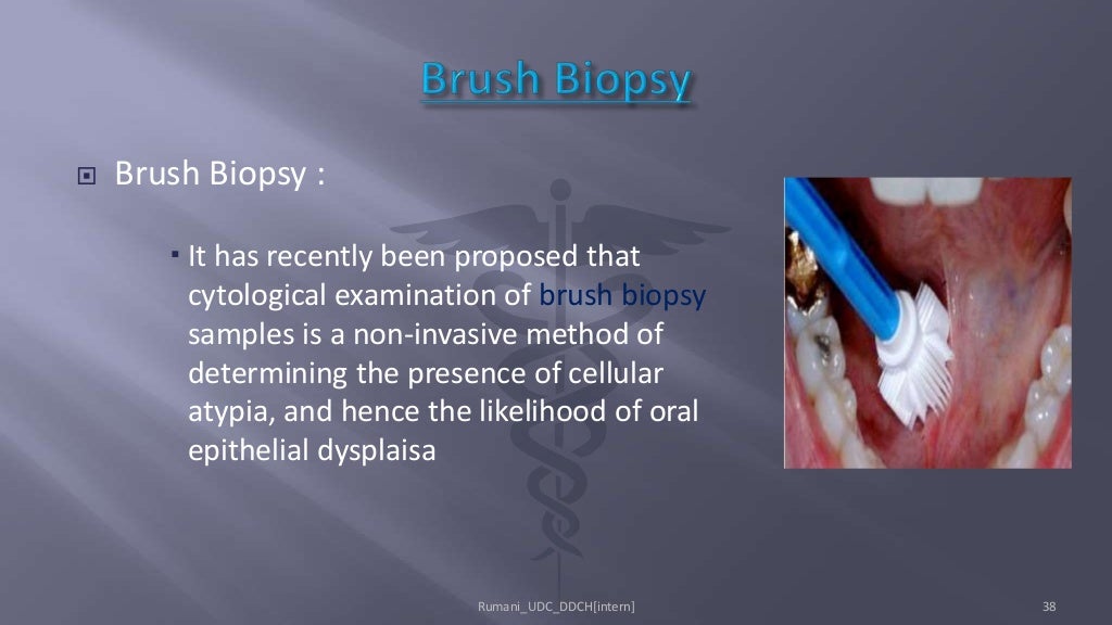 Biopsy in Oral Surgery