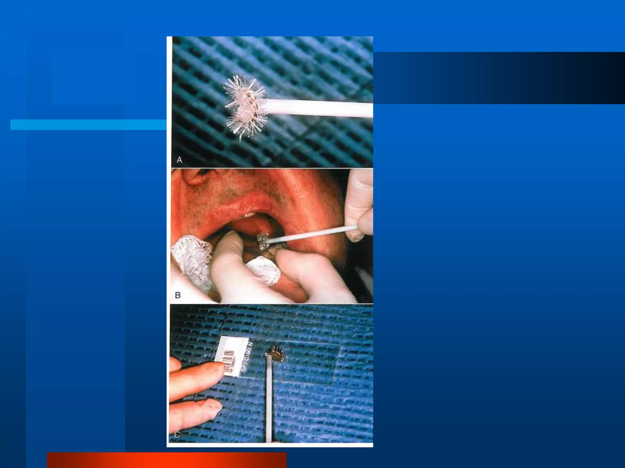 Principles and Techniques of Biopsy | PPT
