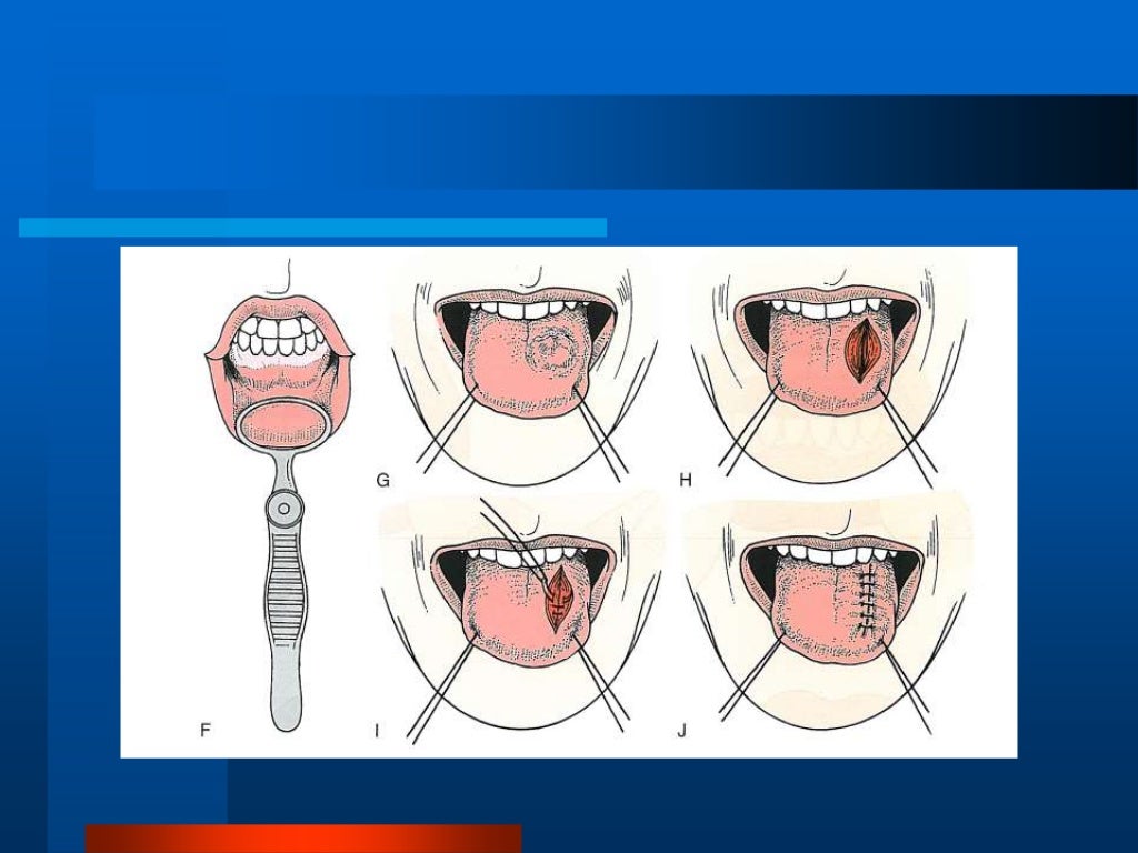 Principles And Techniques Of Biopsy