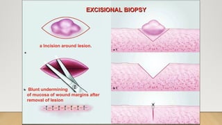 BIOPSY IN SURGERY 1 [Auto-savedd] 3.pptx