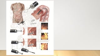 BIOPSY IN SURGERY 1 [Auto-savedd] 3.pptx