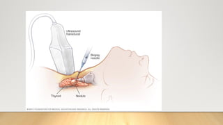 BIOPSY IN SURGERY 1 [Auto-savedd] 3.pptx