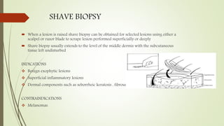 biopsy technique.pptx