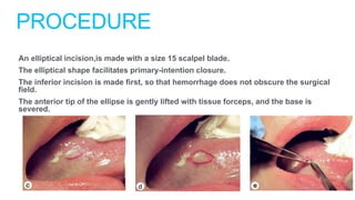 Biopsy Techniques.pptx