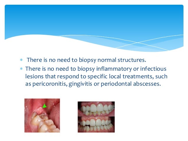 Biopsy Techniques In Oral Surgery