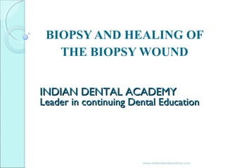 BIOPSY AND HEALING OF
THE BIOPSY WOUND
INDIAN DENTAL ACADEMYINDIAN DENTAL ACADEMY
Leader in continuing Dental EducationLeader in continuing Dental Education
www.indiandentalacademy.com
 