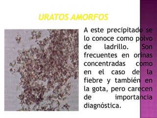A este precipitado se
lo conoce como polvo
de
ladrillo.
Son
frecuentes en orinas
concentradas como
en el caso de la
fiebre y también en
la gota, pero carecen
de
importancia
diagnóstica.

 
