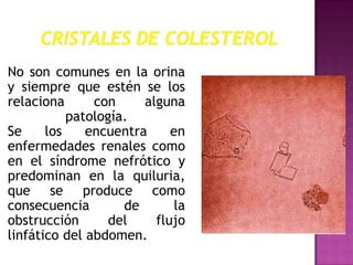 No son comunes en la orina
y siempre que estén se los
relaciona
con
alguna
patología.
Se
los
encuentra
en
enfermedades renales como
en el síndrome nefrótico y
predominan en la quiluria,
que se produce como
consecuencia
de
la
obstrucción
del
flujo
linfático del abdomen.

 