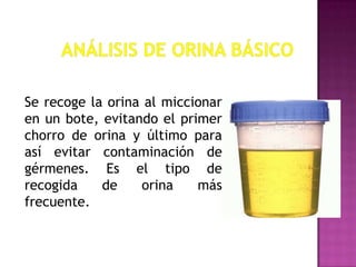 Se recoge la orina al miccionar
en un bote, evitando el primer
chorro de orina y último para
así evitar contaminación de
gérmenes. Es el tipo de
recogida
de
orina
más
frecuente.

 