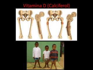 Vitamina D (Calciferol)