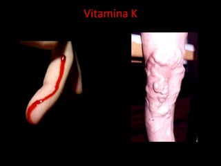 Vitamina K 