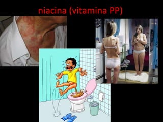 niacina (vitamina PP)