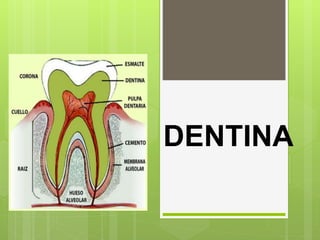 DENTINA
 