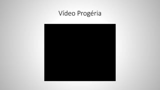Vídeo Progéria
 