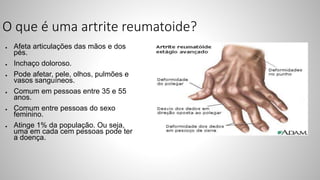 O que é uma artrite reumatoide?
● Afeta articulações das mãos e dos
pés.
● Inchaço doloroso.
● Pode afetar, pele, olhos, pulmões e
vasos sanguíneos.
● Comum em pessoas entre 35 e 55
anos.
● Comum entre pessoas do sexo
feminino.
● Atinge 1% da população. Ou seja,
uma em cada cem pessoas pode ter
a doença.
 