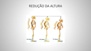REDUÇÃO DA ALTURA
 