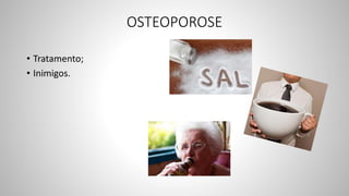 OSTEOPOROSE
• Tratamento;
• Inimigos.
 