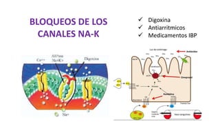 Digoxina
 Antiarritmicos
 Medicamentos IBP
BLOQUEOS DE LOS
CANALES NA-K
 
