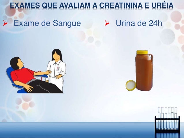 Exame ureia