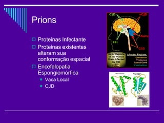 Prions Proteínas Infectante Proteínas existentes alteram sua conformação espacial Encefalopatia Espongiomórfica Vaca Local CJD 