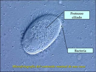 Protozoo
ciliado

Bacteria

Microfotografía del contenido ruminal de una vaca

 