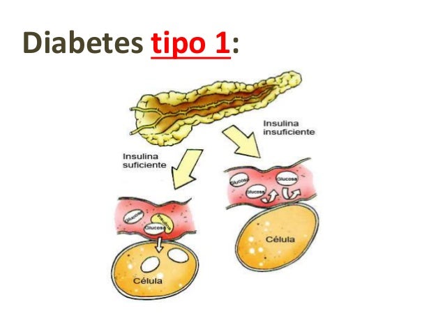 Bioquímica del desarrollo de la diabetes mellitus tipo 2 Bioquímica del desarrollo de la diabetes mellitus tipo 2