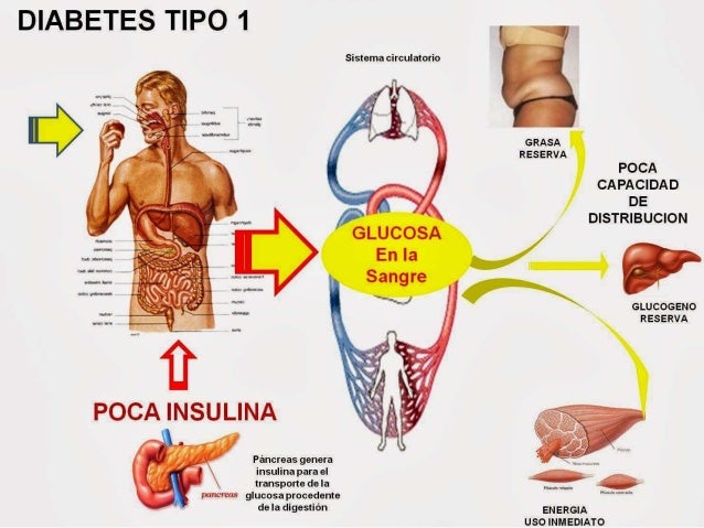 Resultado de imagem para diabetes mellitus