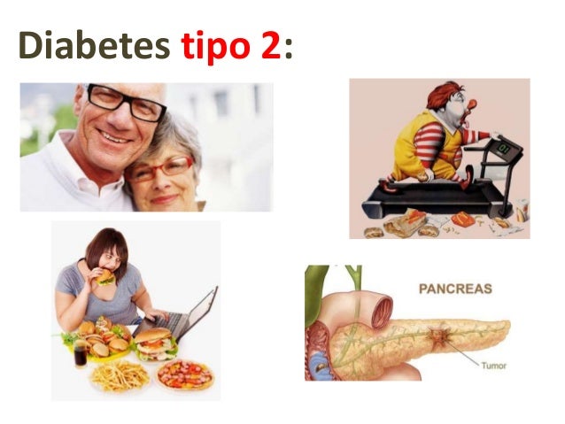 Bioquímica del desarrollo de la diabetes mellitus tipo 2 Bioquímica del desarrollo de la diabetes mellitus tipo 2