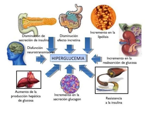 Bioquímica del desarrollo de la diabetes mellitus tipo 2 Bioquímica del desarrollo de la diabetes mellitus tipo 2