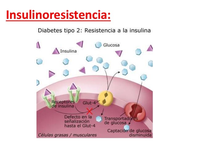 Mira como revertir la diabetes tipo 2 para que nunca tenga Mira como revertir la diabetes tipo 2 para que nunca tenga